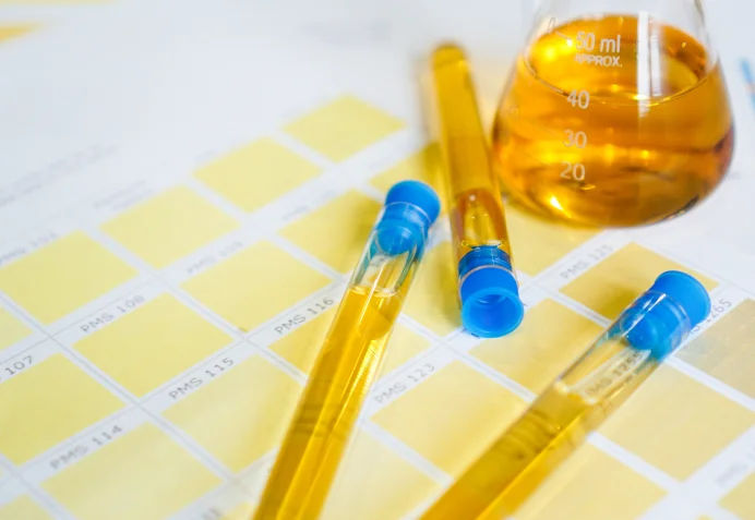 blood test with urine examination